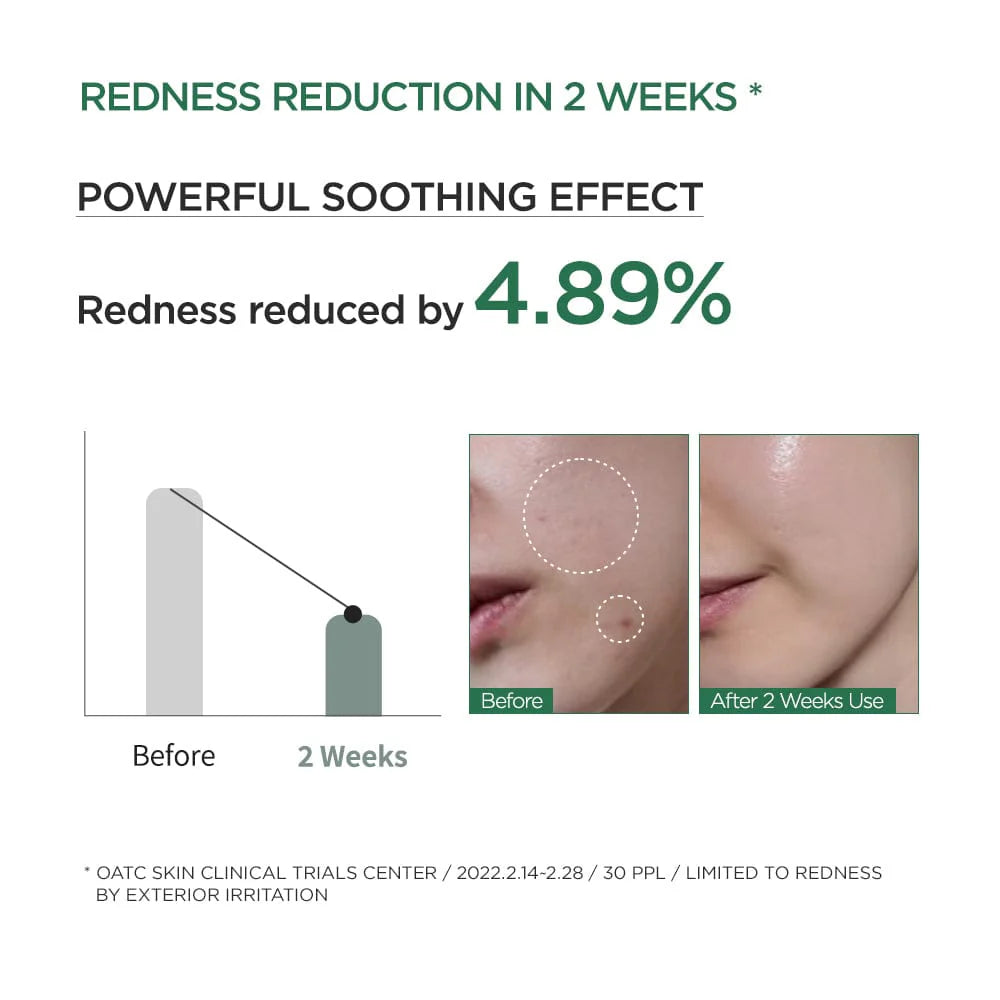 Heartleaf 80% Moisture Soothing Ampoule - Image 4